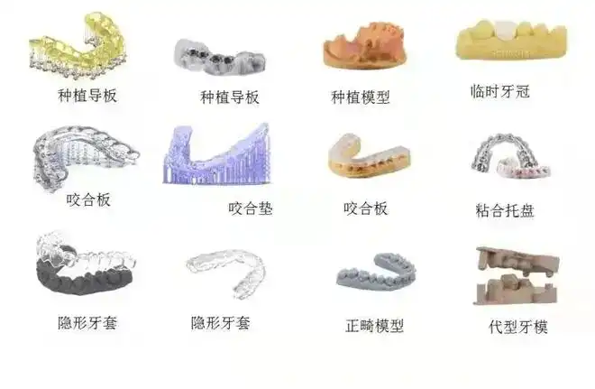 Bioprotez Modelinin Fərdiləşdirməsi Xəstə Baxımında Necə Devrim Edir?